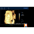 3D 4D USG Full digital 4D Ultrasound Price Trolley 4D Ultrasound Machine